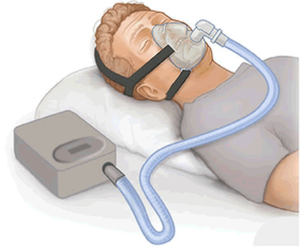 Picture of Philips CPAP Machines