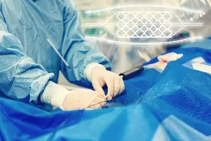 Two doctors in operating room performing stint assisted coiling