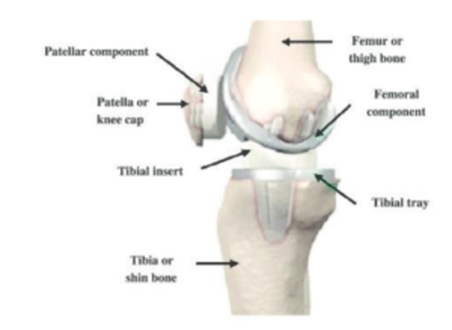 Picture of a knee