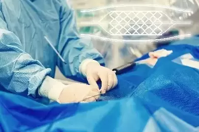 Doctor performing neurovascular stent operation and tying off stent.
